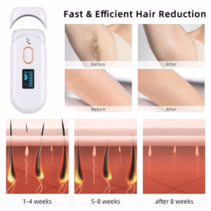 Photo epilator Reach IPL-1 white